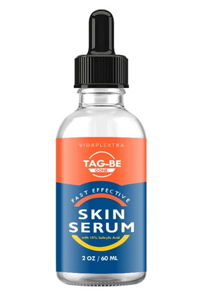 Tag be gone skin tag remover